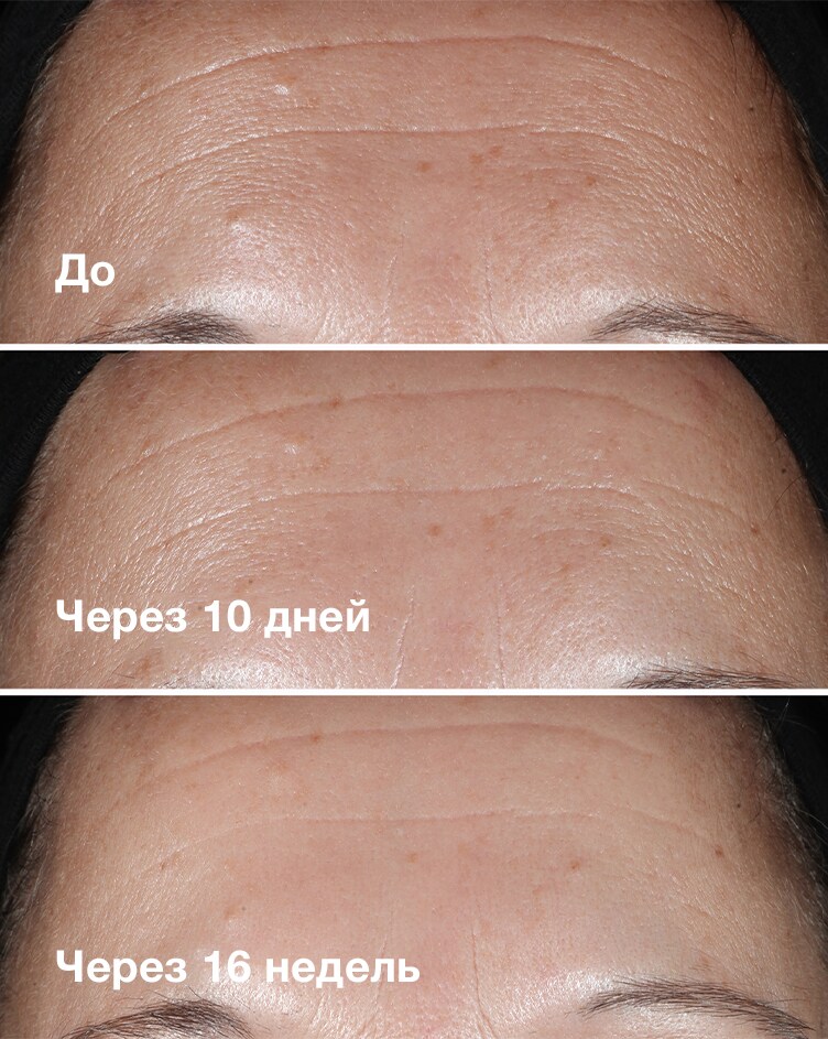 До и после
